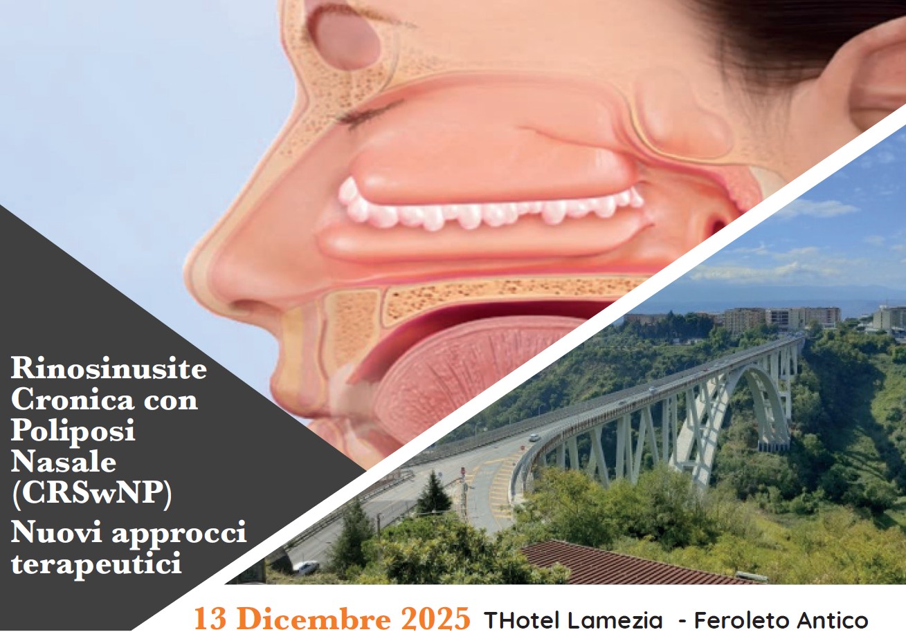 RINOSINUSITE CRONICA CON POLIPOSI NASALE (CRSWNP ) NUOVI APPROCCI TERAPEUTICI